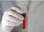 Гормоны ЛГ и ФСГ: роль в организме женщины