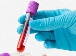 Фолликулостимулирующий гормон (ФСГ): норма у женщин и мужчин