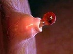 Фолликулогенез: причины нарушения, методы диагностики