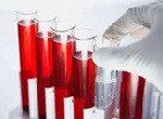 Фолликулостимулирующий гормон: роль в организме человека