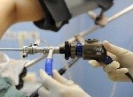 Диагностика и лечение с помощью гистероскопии